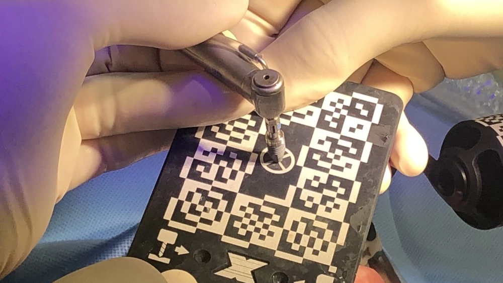 医療法人社団悠和会 北野坂鳥居歯科医院 インプラントの画像