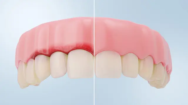 ブルーラジカルの役割と期待できる効果の画像