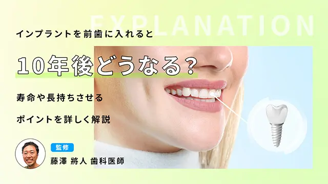 インプラントを前歯に入れると10年後どうなる？寿命や長持ちさせるポイントを詳しく解説の画像