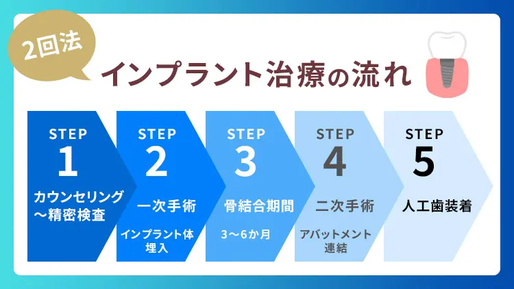 インプラント治療の手順と流れ【2回法】の画像