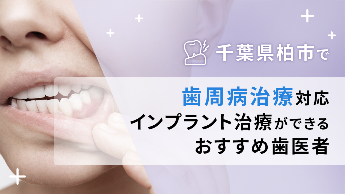 千葉県柏市で歯周病治療対応のインプラント治療ができるおすすめ歯医者5選の画像