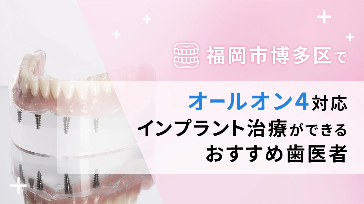 福岡市博多区でオールオン4対応のインプラント治療ができるおすすめ歯医者4選の画像