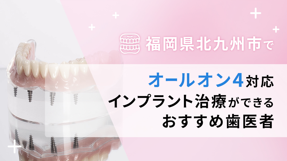 福岡県北九州市でオールオン4対応のインプラント治療ができるおすすめ歯医者6選の画像