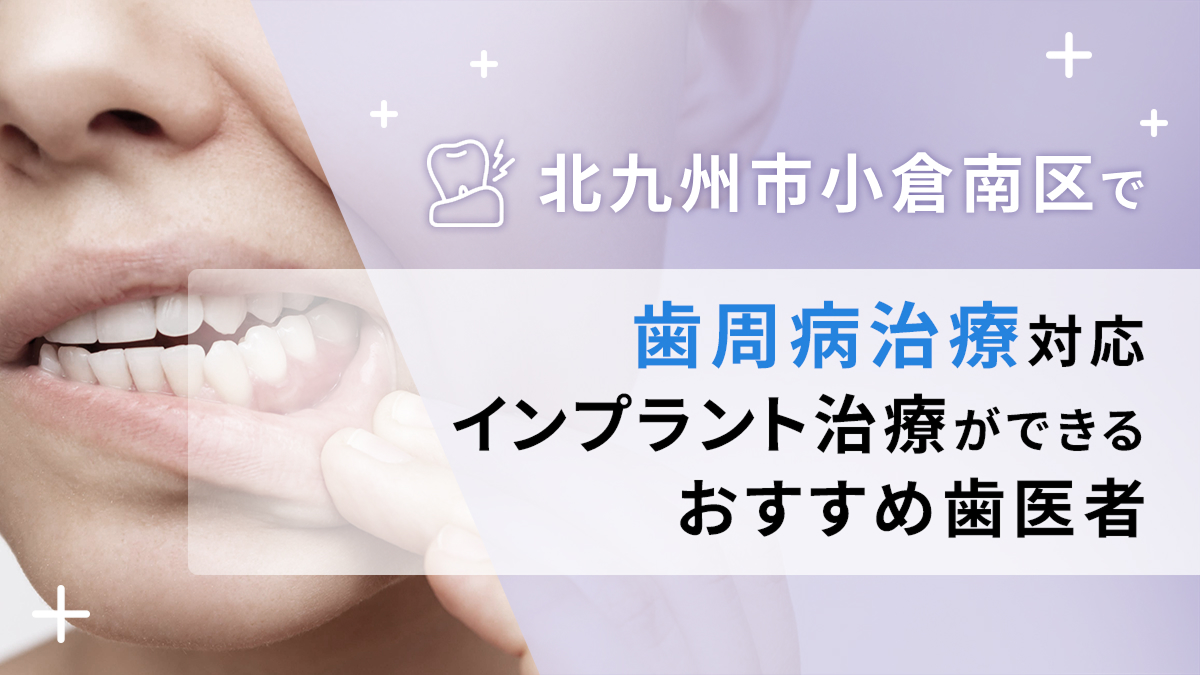 北九州市小倉南区で歯周病治療対応のインプラント治療ができるおすすめ歯医者5選の画像