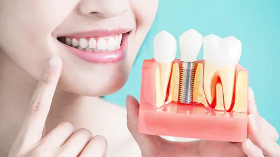 インプラントができるおすすめの歯医者の画像
