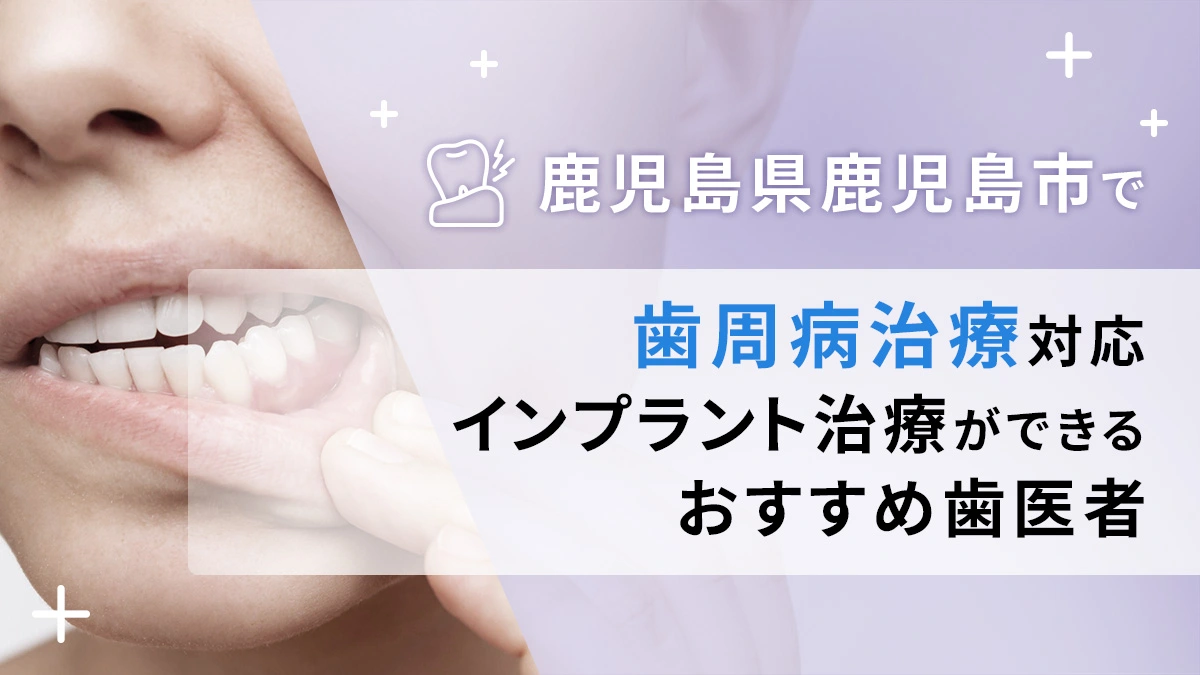 鹿児島県鹿児島市で歯周病治療対応のインプラント治療ができるおすすめ歯医者5選の画像