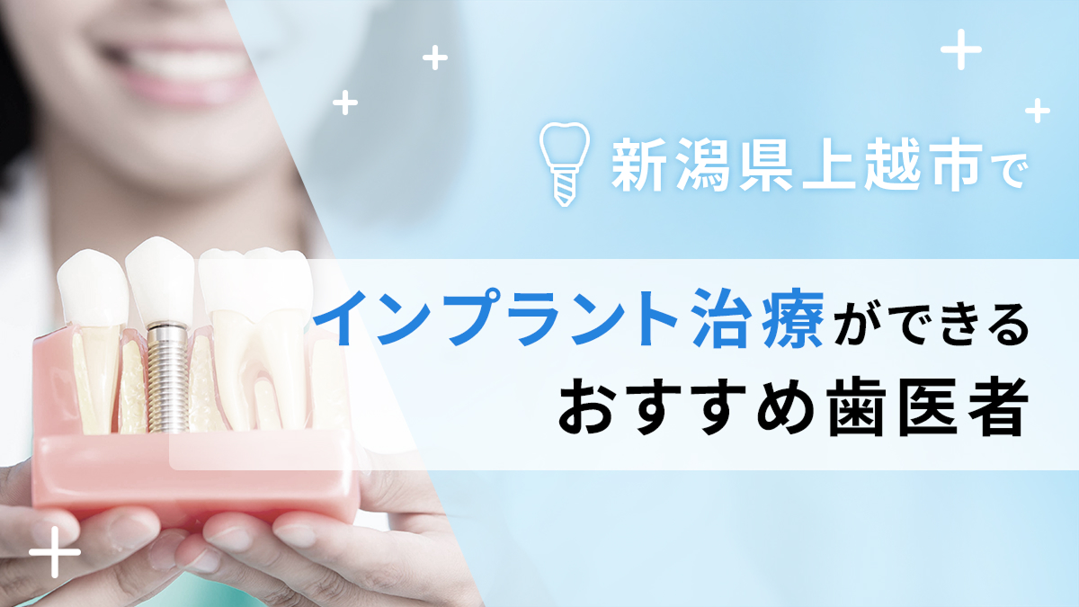 新潟県上越市でインプラント治療ができるおすすめ歯医者5選の画像