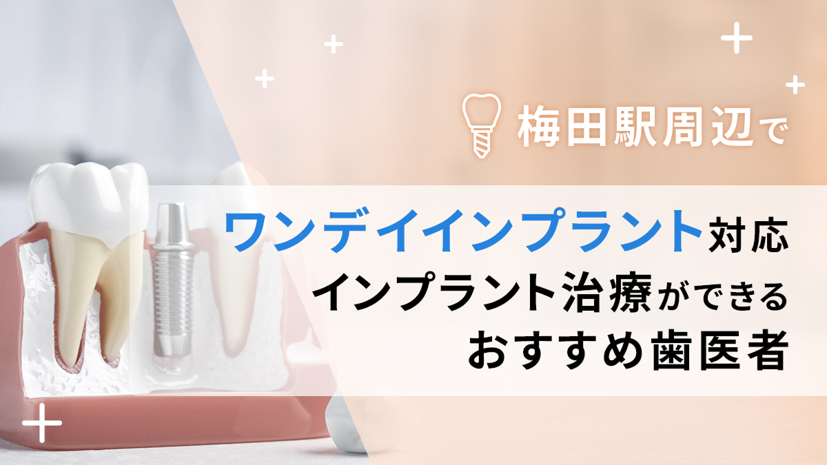 梅田駅周辺でワンデイインプラント対応のインプラント治療ができるおすすめ歯医者5選の画像