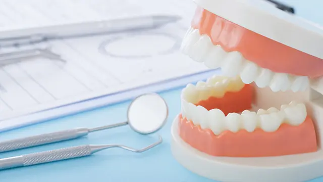 インプラントの再治療とは？の画像