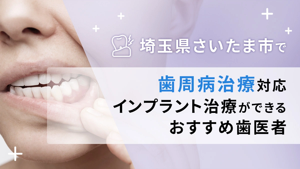 埼玉県さいたま市で歯周病治療対応のインプラント治療ができるおすすめ歯医者5選の画像
