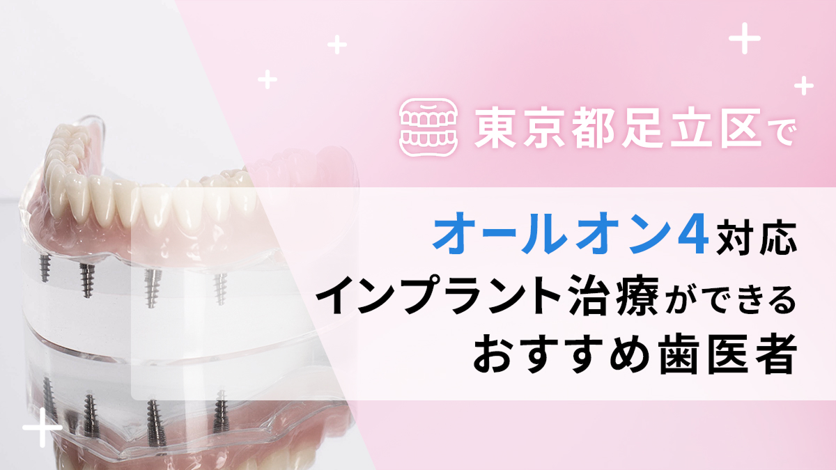 東京都足立区でオールオン4対応のインプラント治療ができるおすすめ歯医者3選の画像