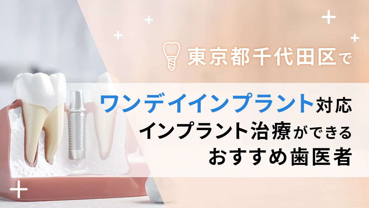 東京都千代田区でワンデイインプラント対応のインプラント治療ができるおすすめ歯医者5選の画像