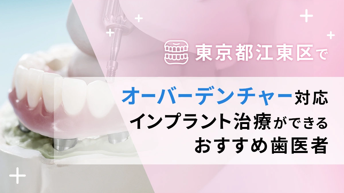 東京都江東区でオーバーデンチャー対応のインプラント治療ができるおすすめ歯医者5選の画像