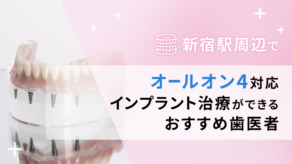 新宿駅周辺でオールオン4対応のインプラント治療ができるおすすめ歯医者5選の画像