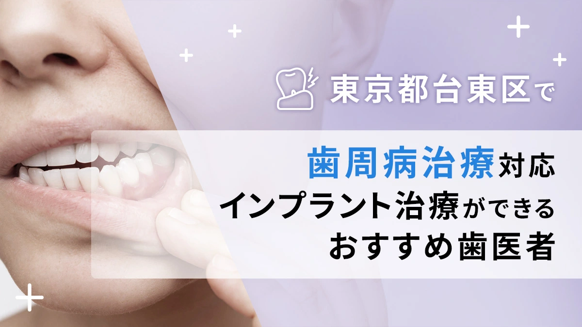 東京都台東区で歯周病治療対応のインプラント治療ができるおすすめ歯医者5選の画像