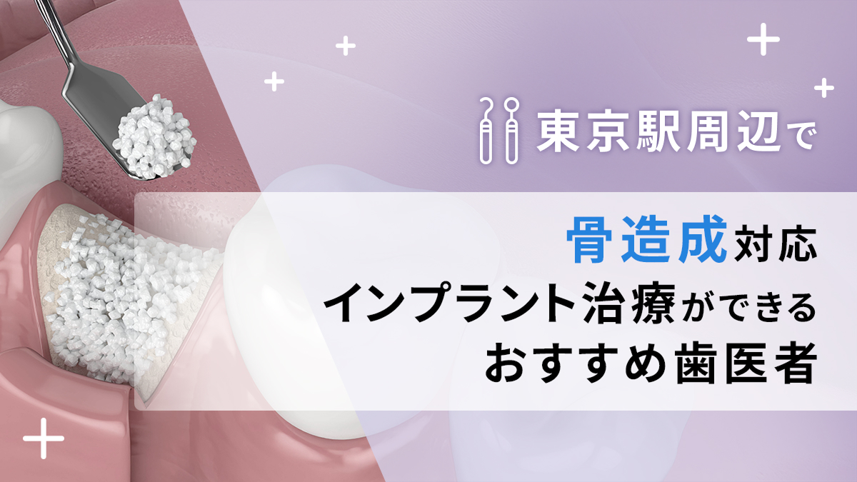 東京駅周辺で骨造成対応のインプラント治療ができるおすすめ歯医者5選の画像